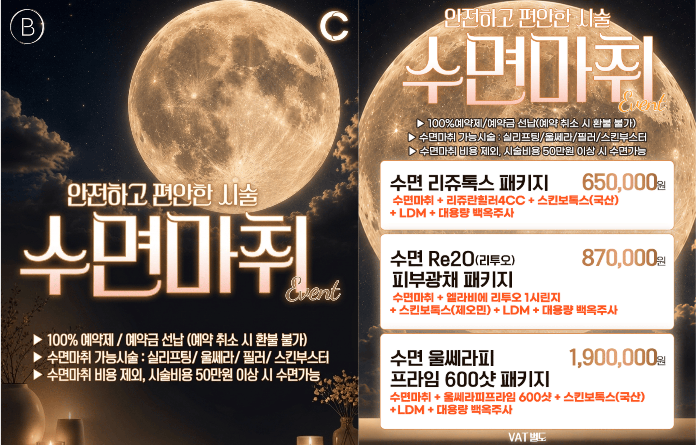 수면마취